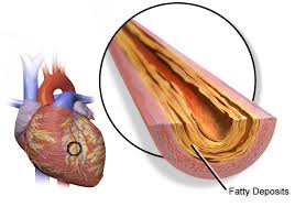 Heart Coronary