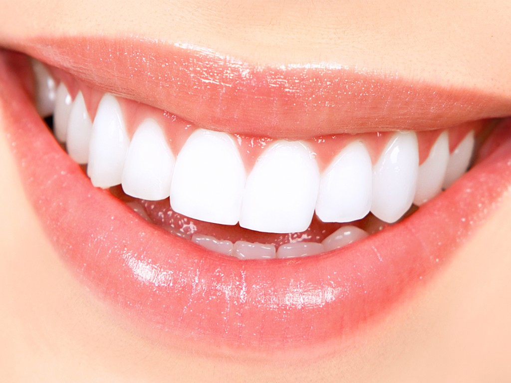 Teeth whitening