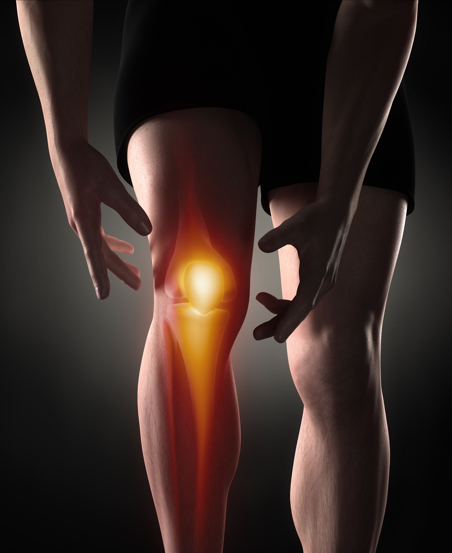 Weights You Should Be Lifting With An Arthritic Knee