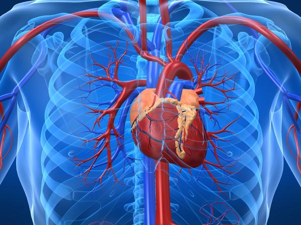 6 Causes Of Enlarged Heart