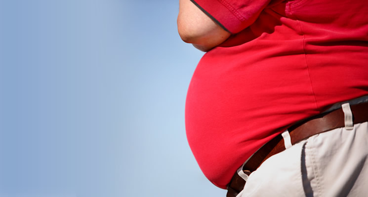 3 Most Common Misconceptions About Obesity