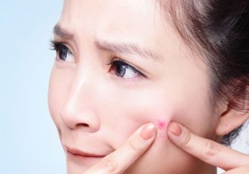 5 Easy Ways To Prevent Pimples