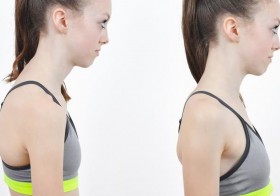 4 Exercises to Help Correct Your Child’s Posture