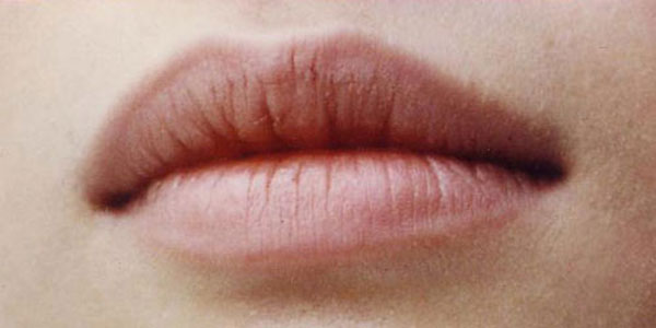 5 Things About Lip Health You Need to Know